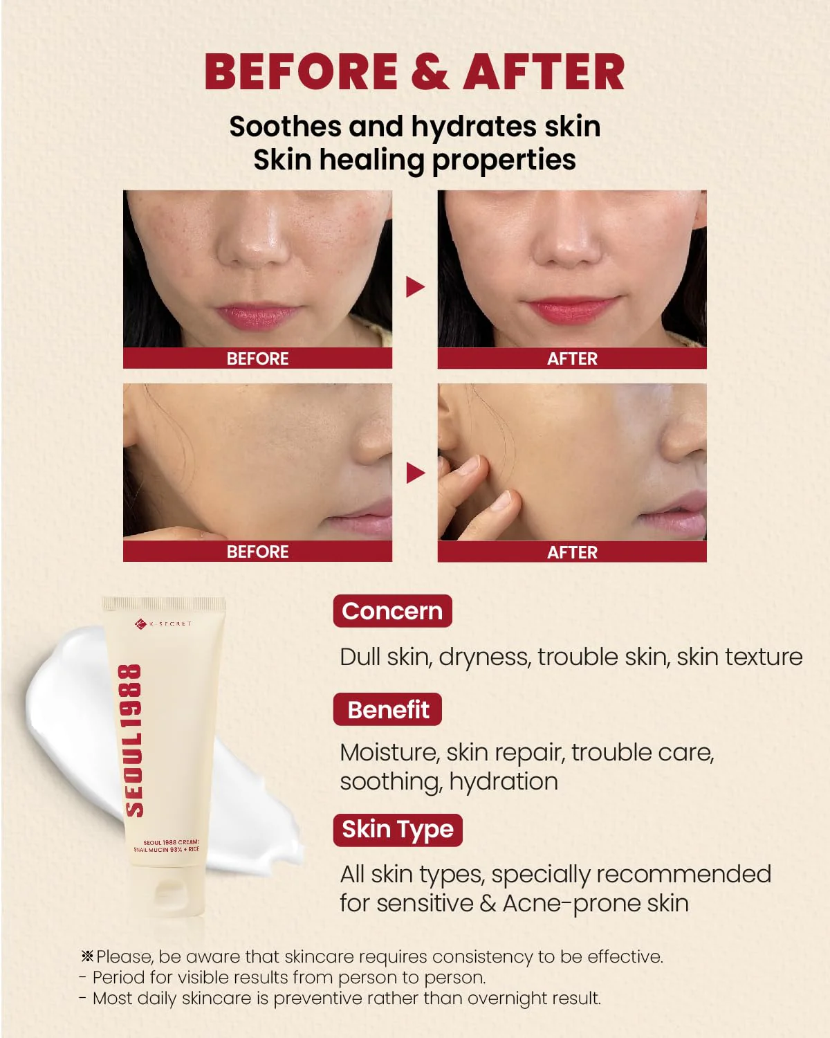KSECRET Seoul 1988 Cream : Snail Mucin 93% + Rice 100ml - Image 4