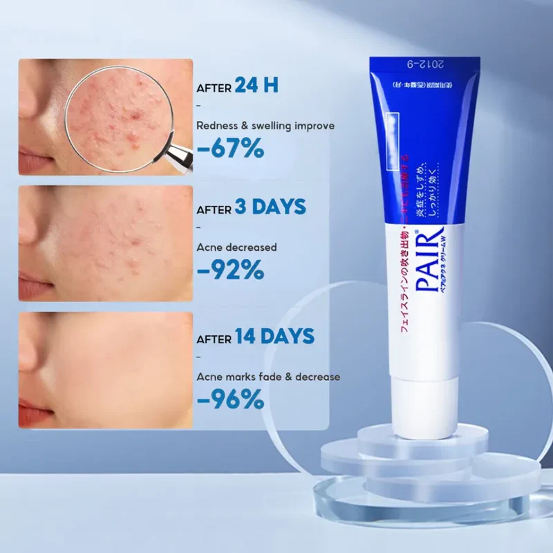 LION Pair Acne Cream 24g - Image 2