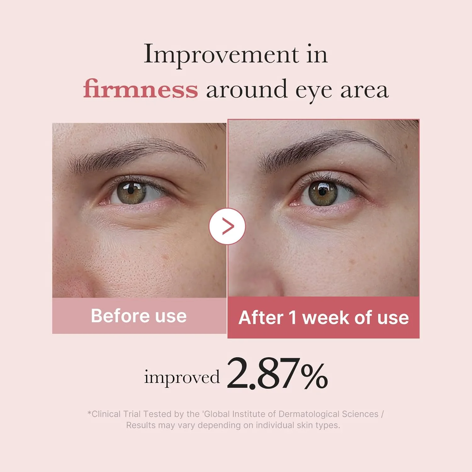 MEDICUBE PDRN Pink Peptide Eye Cream 30ml - Image 4